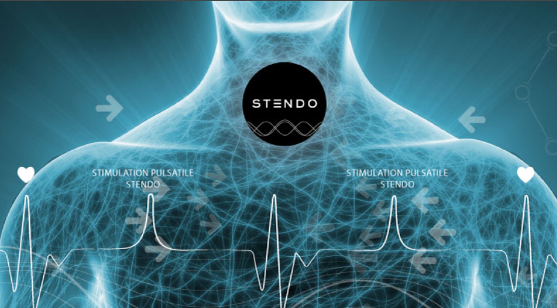 Stendo : une belle levée de fonds pour le laboratoire lovérien